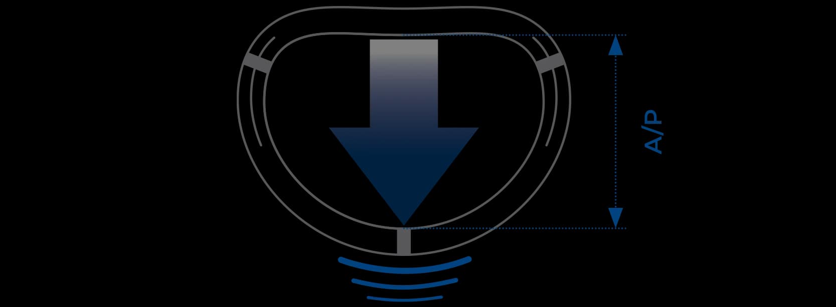 Diagram of a Memo 4D mitral ring showing A/P diameter with motion arrow and flexion waves, illustrating dynamic movement to reduce systolic anterior motion risk